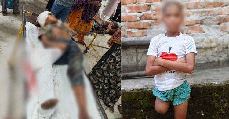 ট্রেন দুর্ঘটনার কারণে পা কাটতে হয়েছিল শিশু রায়হানের, সামনে এলো চাঞ্চল্যকর তথ্য